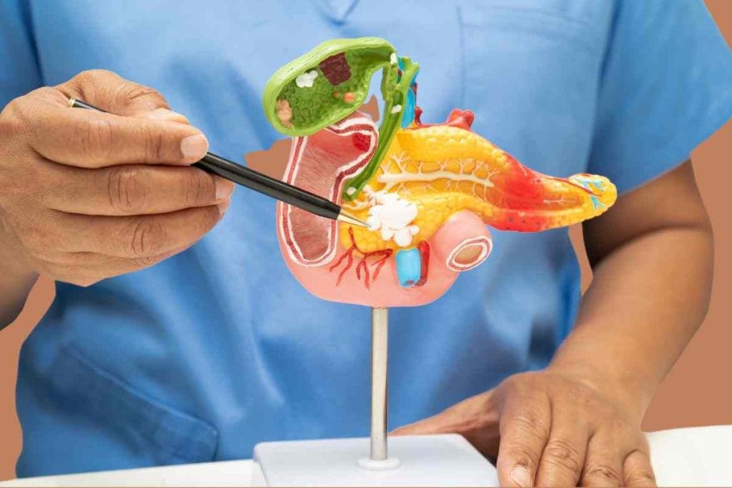 পিত্তথলির পাথর গলানোর হোমিওপ্যাথিক ঔষধ