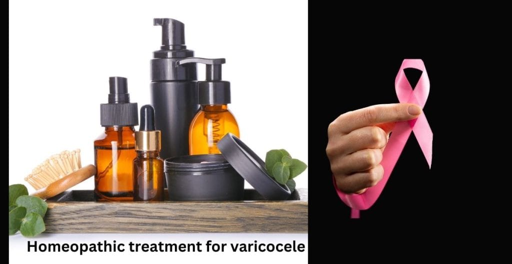 ভেরিকোসিল এর হোমিও চিকিৎসা