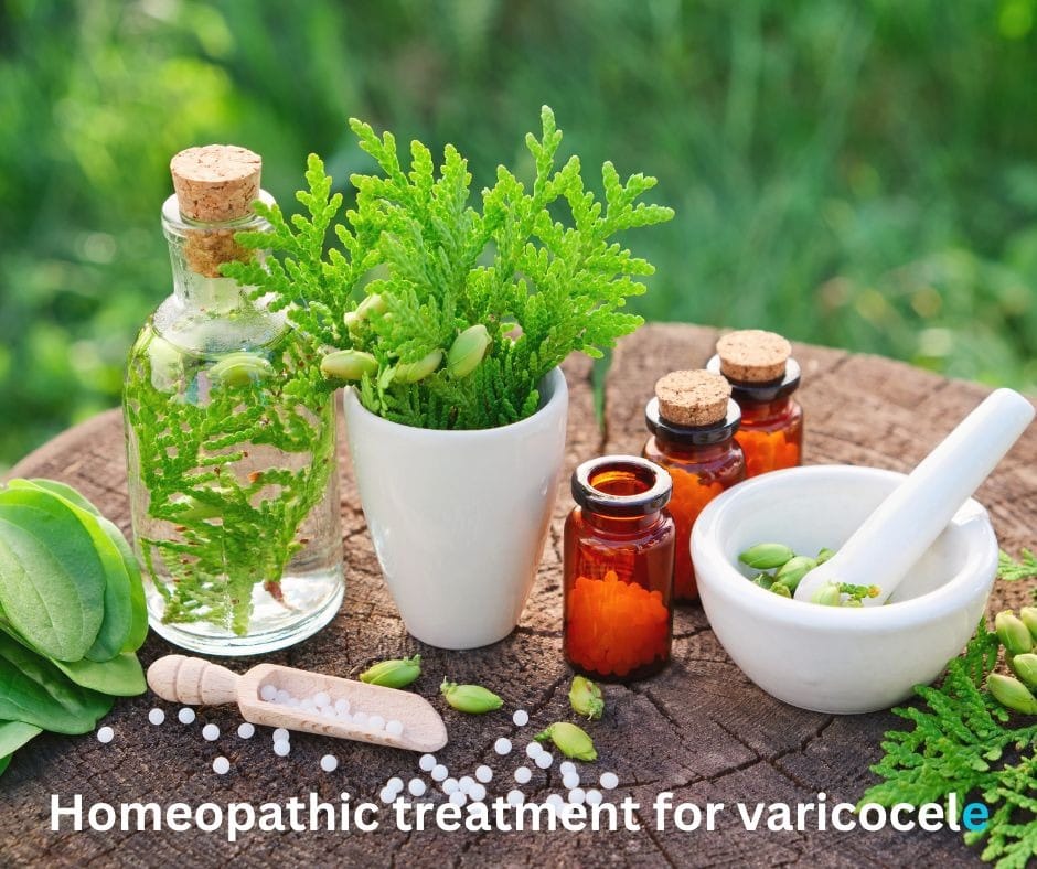 Varicocele treatment without surgery
