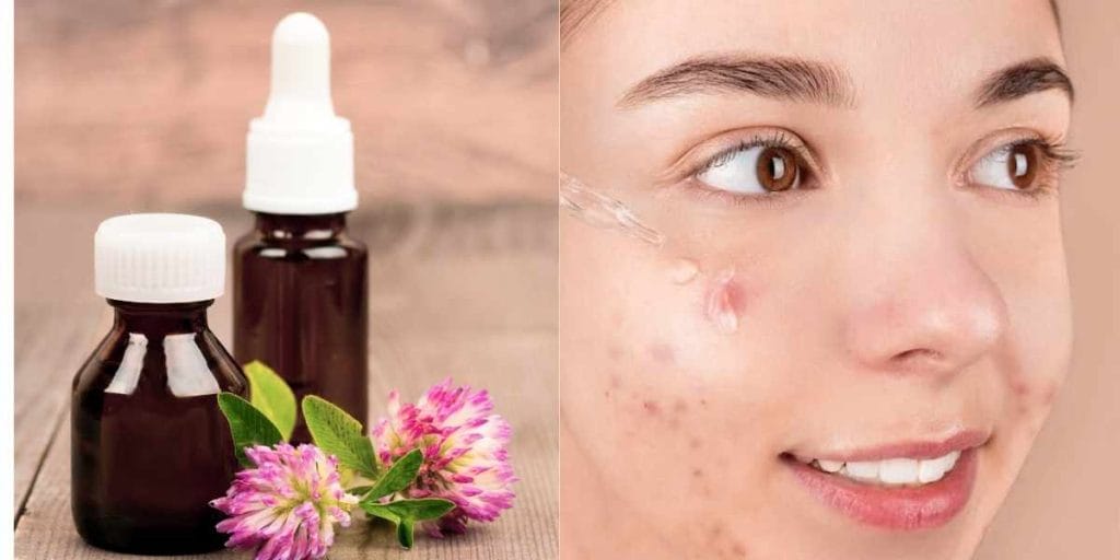 ত্বকের দাগ দূর করতে এই ৪টি হোমিও ওষুধ কাজে দেবে 
