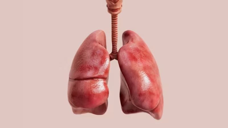 Person with a persistent cough, an early sign of lung cancer